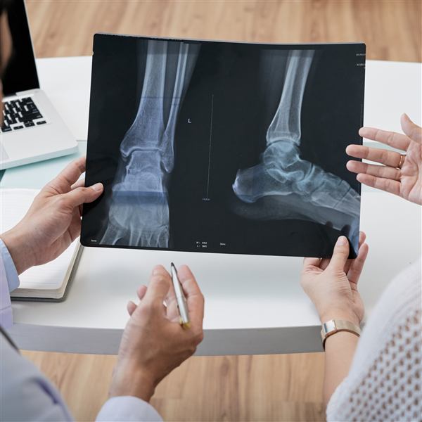 Médico revisando radiografías de tobillo con el paciente